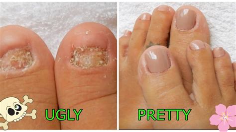 are there fake nails for toes without nails